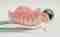Protesi dentaria mobile dentista Centro Dentistico San Lorenzo Brindisi
