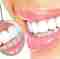 Igiene dentale